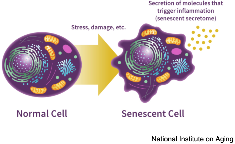Diagram of a normal cell compared to a senescent cell