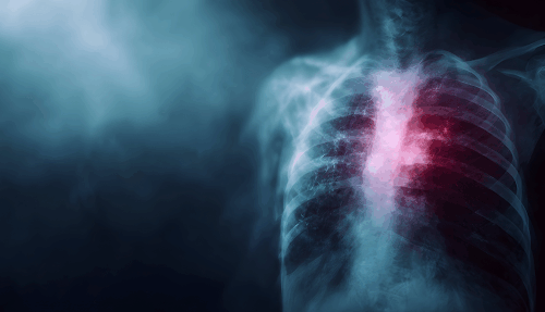 Respiratory system in x-ray form